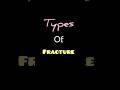 🙂Learn all fracture types quickly”#fracture#typesoffracture#orthopedics#physiotherapy#fyp#viralreels