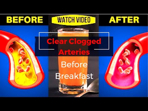 Take This Before Breakfast and Clear Clogged Arteries and Control High Blood Pressure