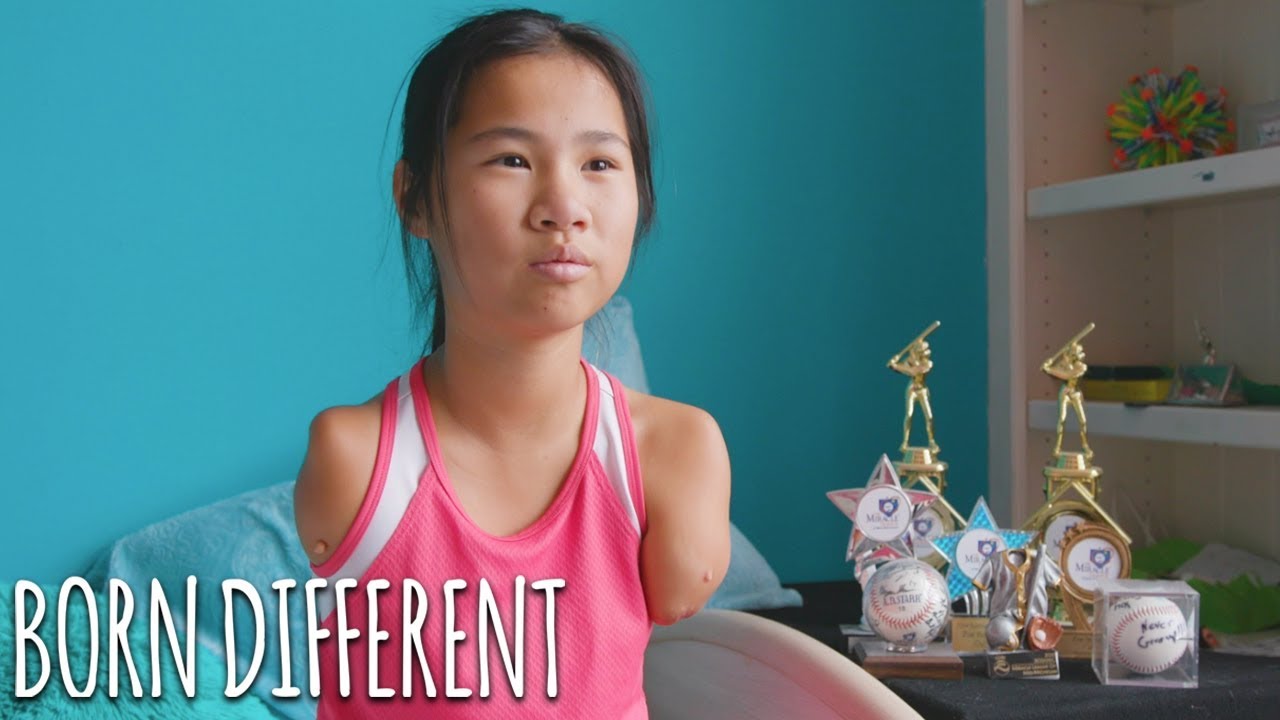 The 12-Year-Old Armless Baseball Player | BORN DIFFERENT