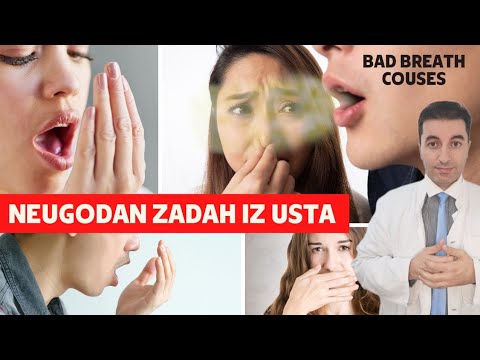 Video: Ali razjeda na želodcu povzroča slab zadah?