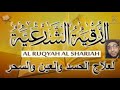 كشف وعلاج السحر في دقائق عمرو خميس القط