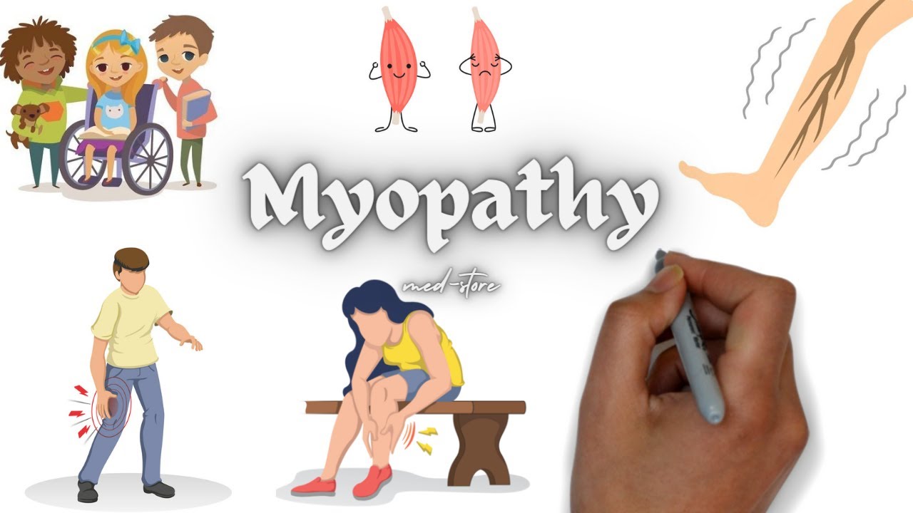 Myopathy (Types, Etiology & Treatment) duchennemusculardystrophy 