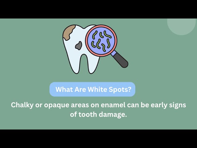 ⁣Preventing White Spots on Your Child’s Teeth