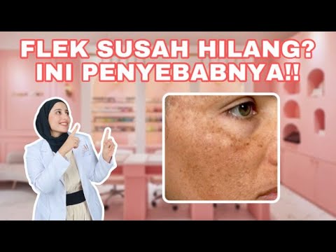 Video: Adakah pencahayaan ceruk akan hilang gaya?