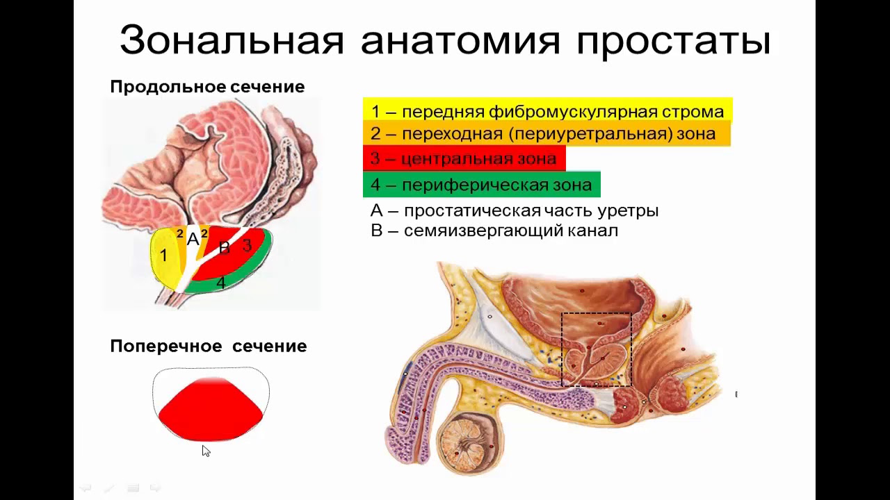 Ультразвуковая анатомия предстательной железы