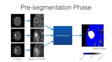 RSNA 2016 ITK-SNAP Training - Automatic Segmentation