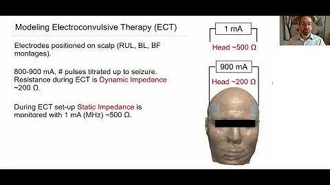 Shared mechanisms of tDCS, tACS, Temporal Interference Stimulation, and ECT
