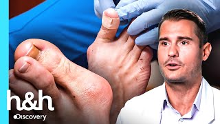 Problemas De Joanete Que Impressionaram O Doutor Brad Meus Pés Estão Me Matando H&H Brasil