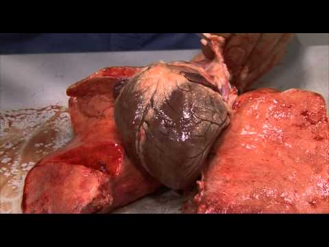 Anatomy 8, Trachea, lungs, heart