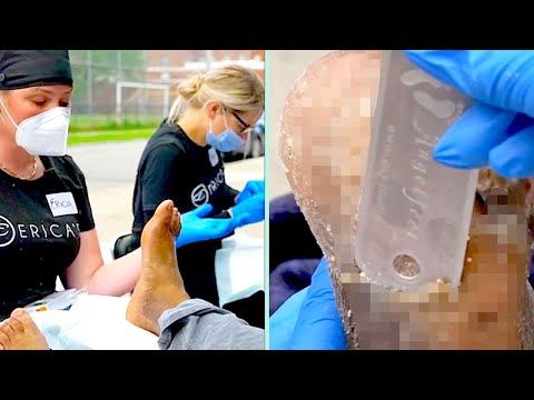 Helping The Homeless With Pedicures: The Nail Technician Getting People Back On Their Feet