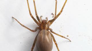 Black Widow or Brown Recluse  Don’t Get it wrong! Black Widow Vs Brown Recluse Usmle Step 1 Step 2 Ck