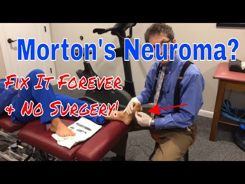 Morton&rsquo;s Neuroma Treatment: Fix it Forever