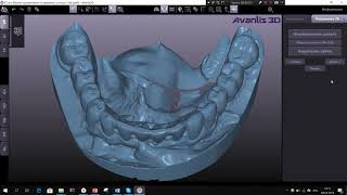 Сборка 3Д сцены при беззубых челюстях Avantis 3D screenshot 3