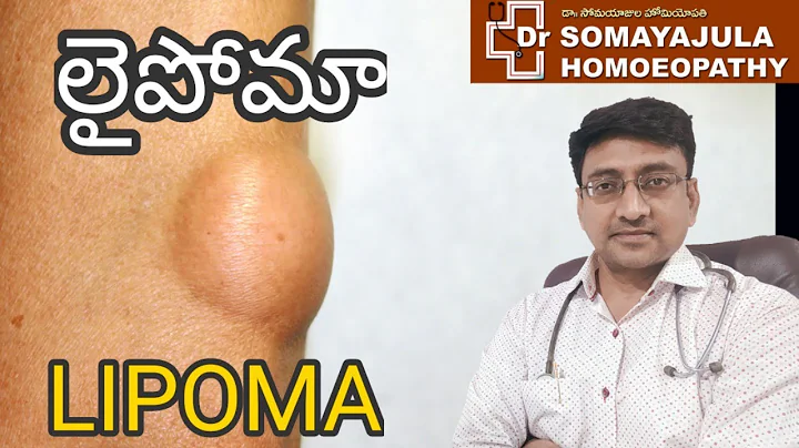 LIPOMA Homeopathic Treatment / Telugu / Dr Suresh ...