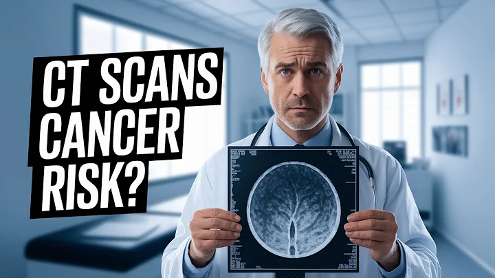 CT Scans and Cancer: A Hidden Risk? || Cancer || CT Scan || Cancer Risk
