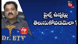 Symptoms of Piles | పైల్స్ ఉన్నట్లు తెలుసుకోవడమెలా | Dr.ETV | 1st April 2021 | ETV Life