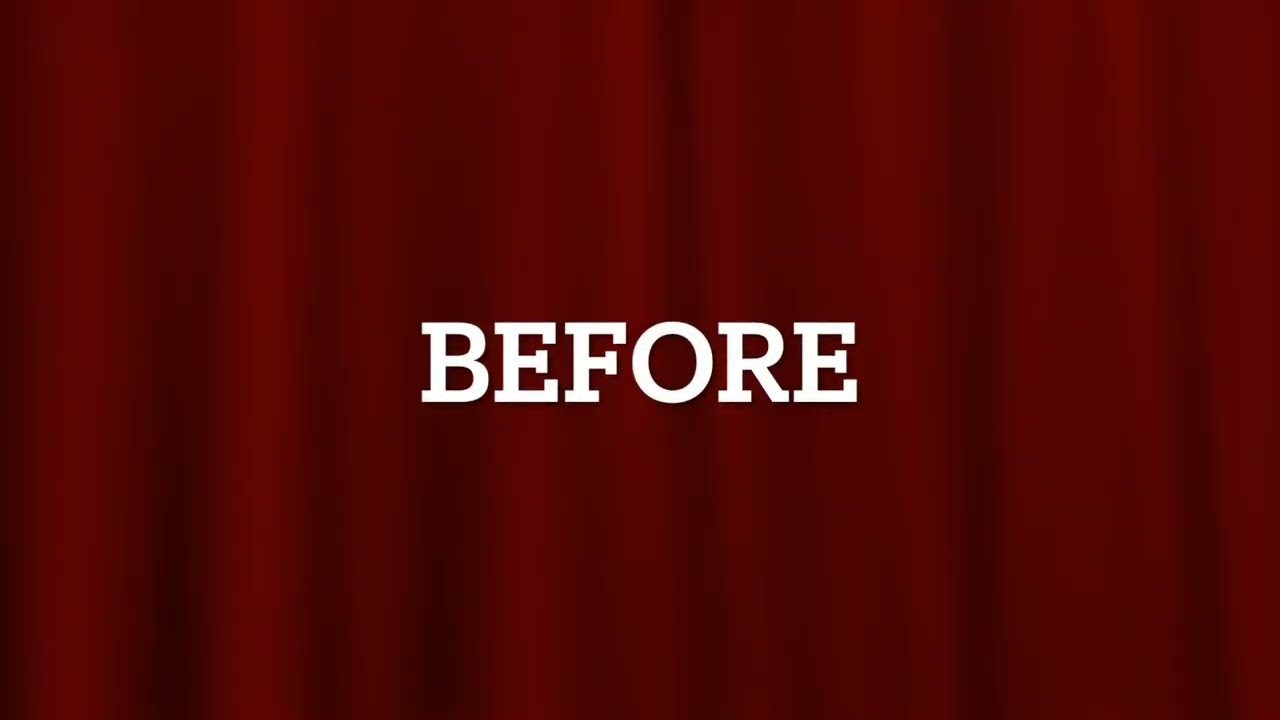 Voice change 2 weeks after voice feminization surgery done by tensioning glottoplasty