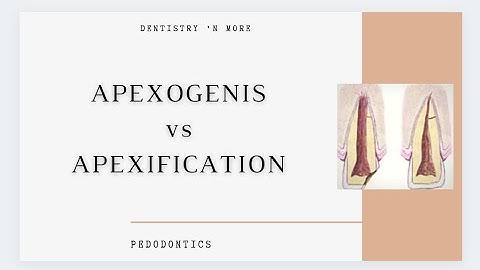 APEXOGENESIS vs APEXIFICATION