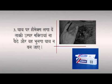 First Aid - Wound Treatment (Hindi) - YouTube