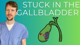 Gallbladder + Bile Duct Disease (explained by a GI doc)