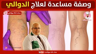 الدوالي : الوقاية والعلاج بوصفات طبيعية من عند الدكتور عماد ميزاب Dr imad mizab