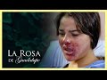 ¡El vapeador de Lili le explota en la cara! | La vida se respira | La Rosa de Guadalupe