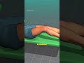 #quadricepstendon #kneesurgery #orthopedics #medicalanimation#3danimation