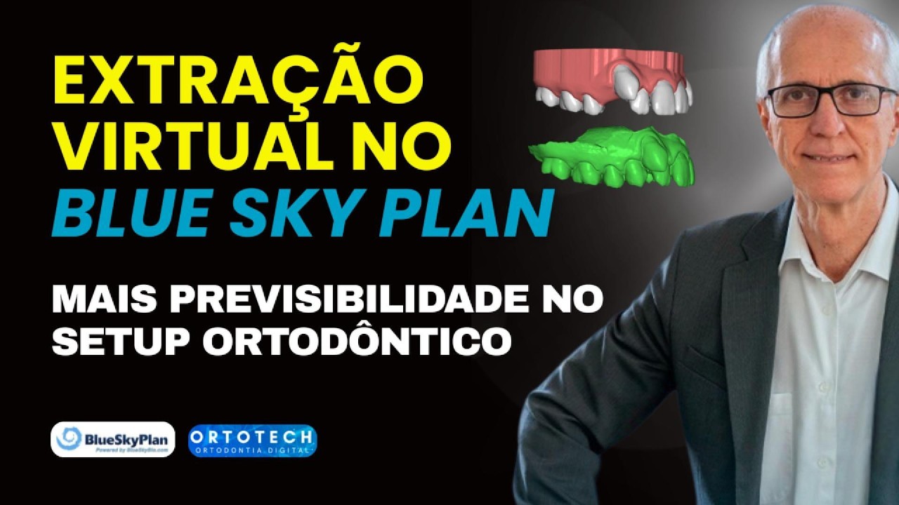 Extração Virtual no Blue Sky Plan: mais previsibilidade no seu setup ortodôntico