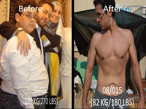 14 Year Old Weight Loss Story