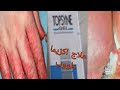 الطريقة الصحيحة لعلاج الالتهابات الجلدية والاكزيما والصدفية ومشاكل البشرة بالاخص باستعمال Topsyne 