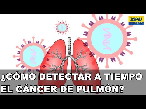 ¿Cómo detectar a tiempo el cáncer de pulmón?