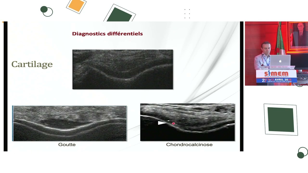 Pr Slimani Rhumatologue