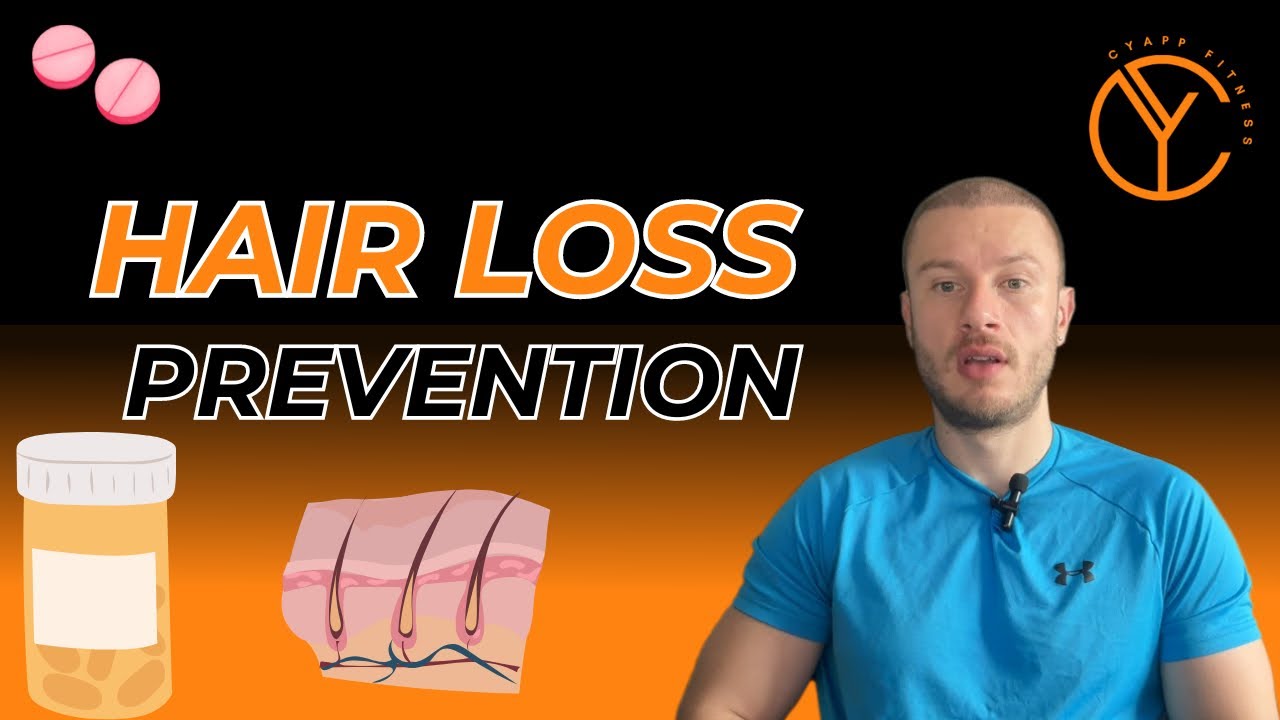 How to prevent hair loss FDA Approved Medication YouTube