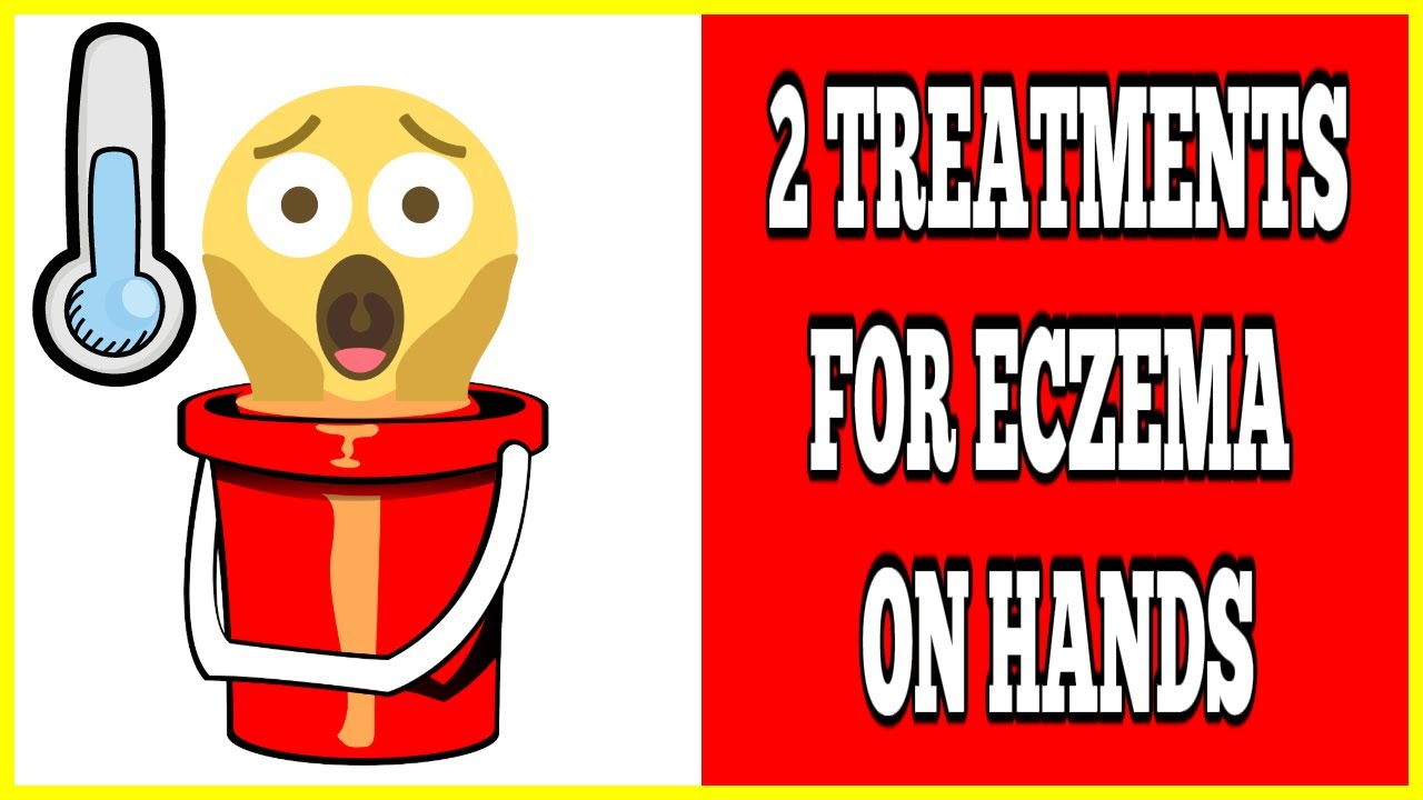 Treatment For Eczema On Hands 2 Treatment For Eczema On Hands YouTube