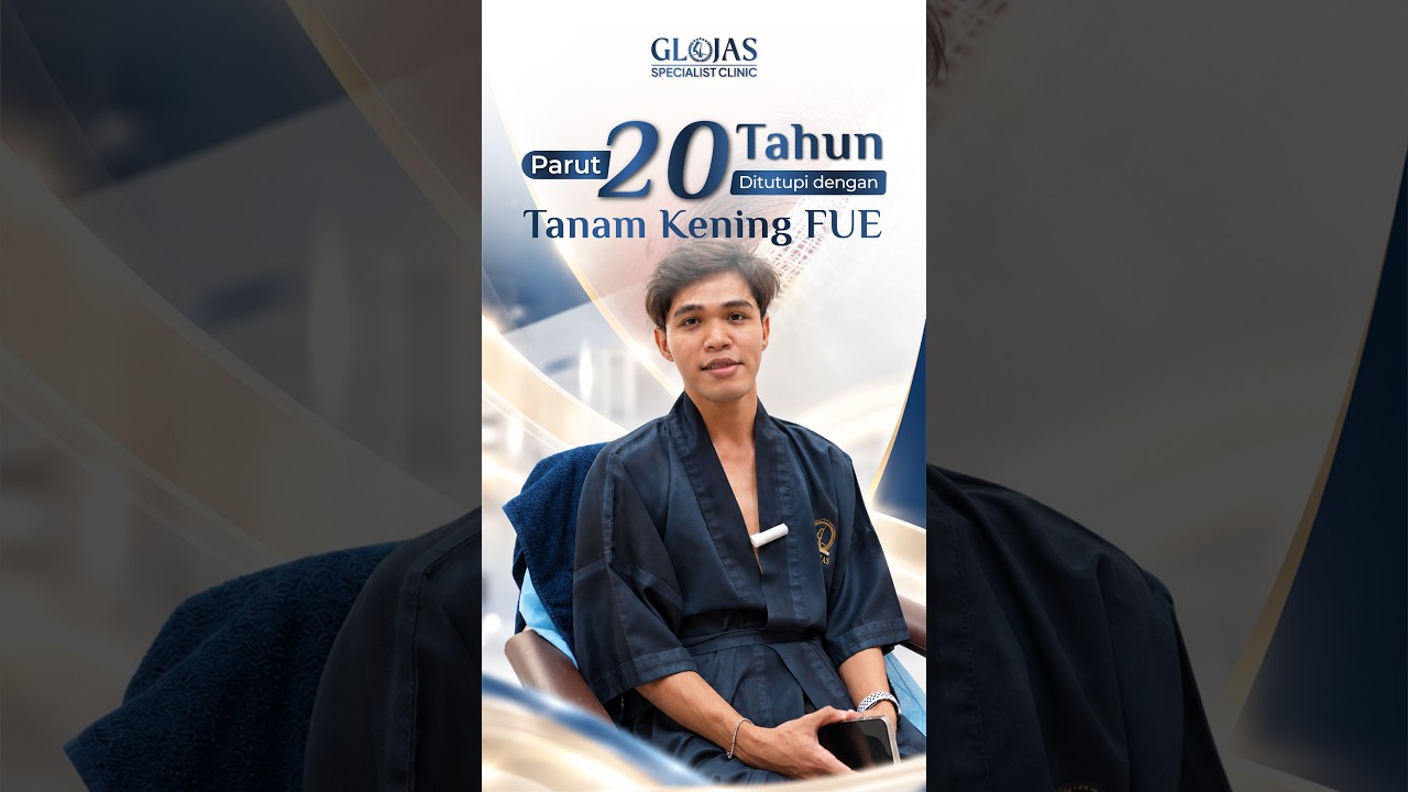 Hair Transplant Malaysia l Parut 20 tahun hilang lepas tanam kening FUE! #hairtransplantmalaysia