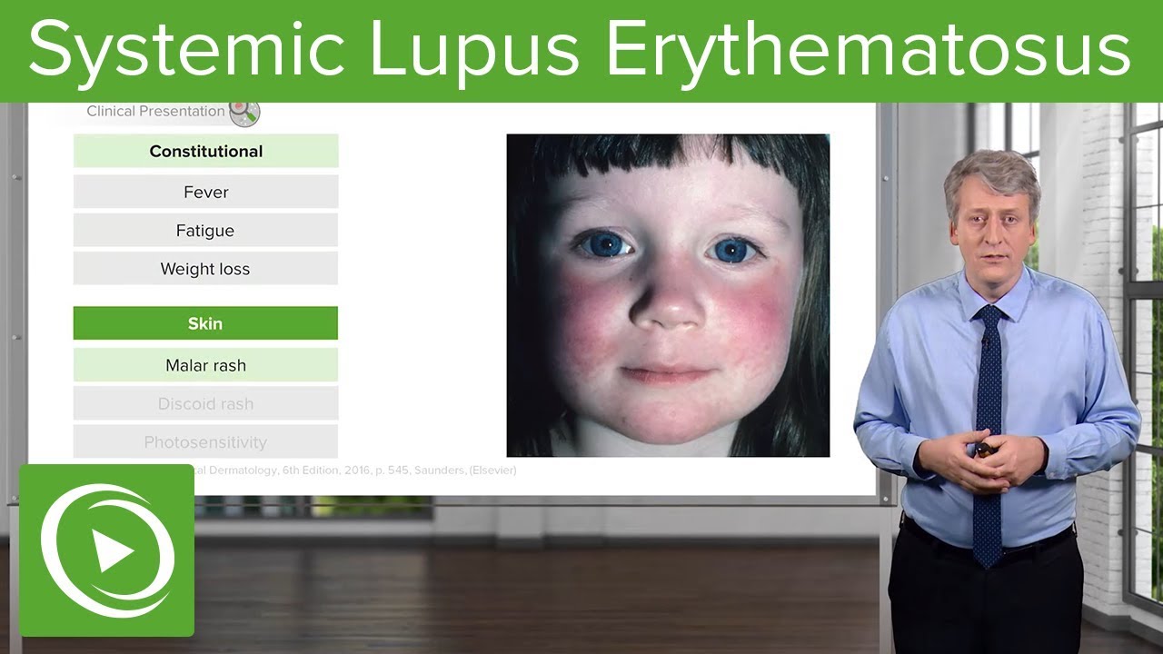 Lupus: Chronische Krankheit oder unterschätzte Gefahr? Anzeichen und Tipps!