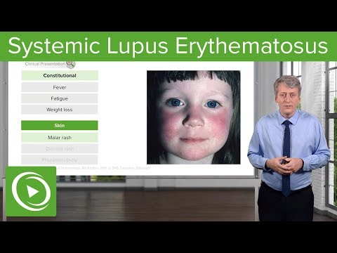 Systemic Lupus Erythematosus (SLE) in Children – Pediatrics | Lecturio