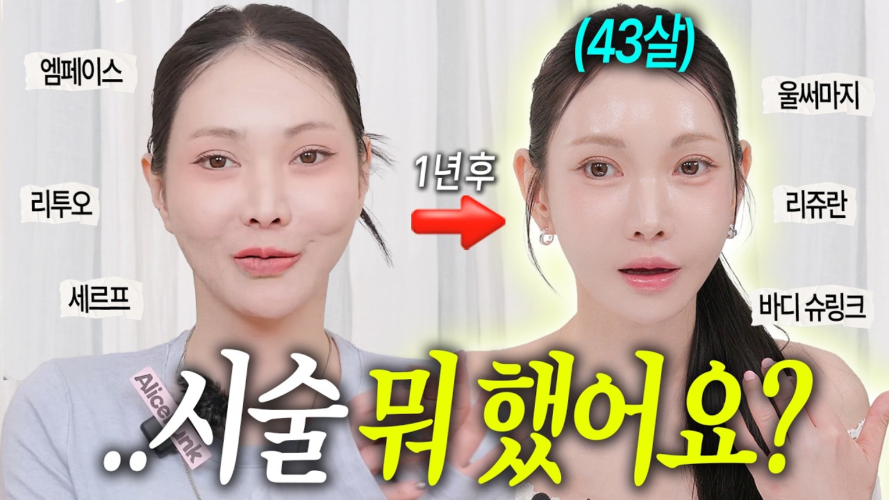야름야금 달라진 이유🔥제대로 확! 효과본 피부과 시술 총정리