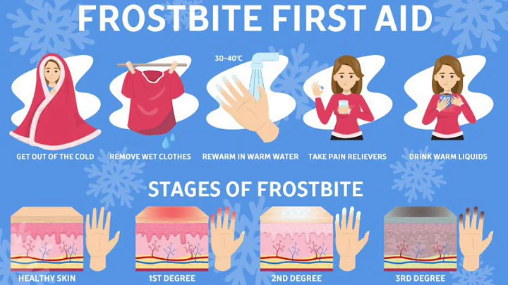 Working in the cold 3