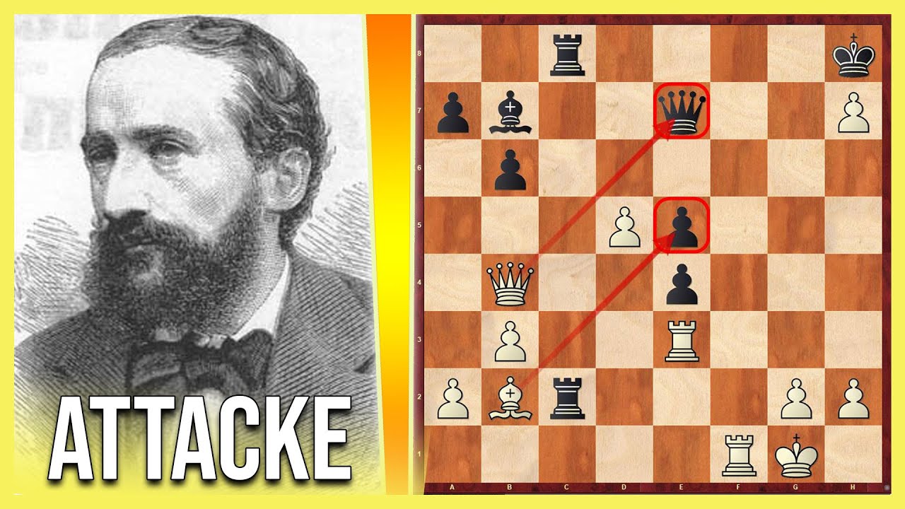 Die Zukertort-ATTACKE! ⚔️