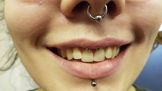 Should the rest of the UK ban intimate piercings