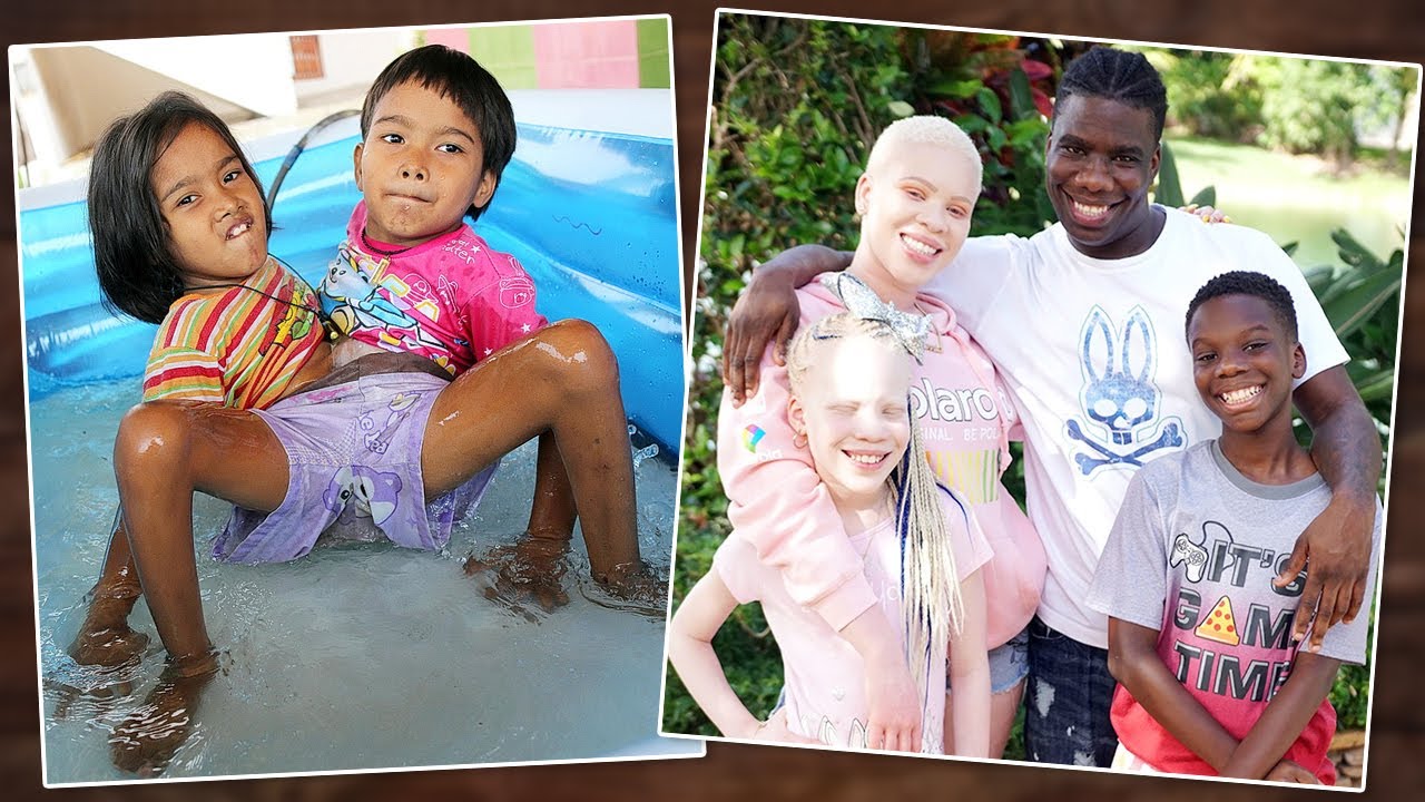 10 ฝาแฝด สุดแปลก ประหลาด ที่โลกต้องตะลึง !! | OKyouLIKEs