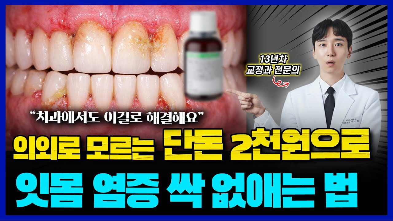 잇몸 염증 없애는법! 단돈 2천원으로 해결하세요. 치과에서도 결국 이걸로 해결합니다