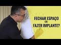 MESIALIZAÇÃO DE MOLARES - Fechar Espaço ou Fazer Implante? - Comparação de métodos e medidas - Aula