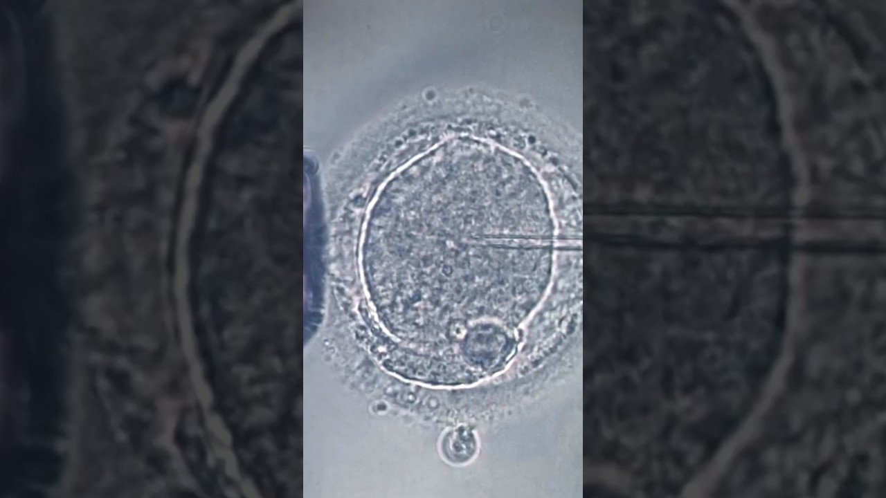 Florida couple sues after IVF mix-up Florida couple sues after IVF mix-up