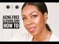 How To Get Acne-Free, Glowing Skin: A Step-By-Step Process | Style Domination by Dominique Baker