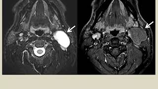 Neck Film Reading 11, Pediatric Neck Masses and Elbow Joint