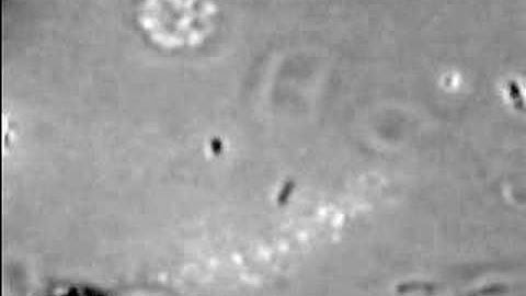 Cellular Biophotonics at UCSD - Chromosome Micromanipulation