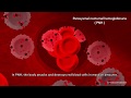 Hemolytic processes in PNH and its treatment: intravascular and extravascular hemolysis