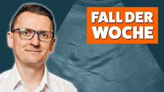 Pathologischer Dhc Und Cholestase So Triffst Du Die Richtigen Entscheidungen - Fall Der Woche